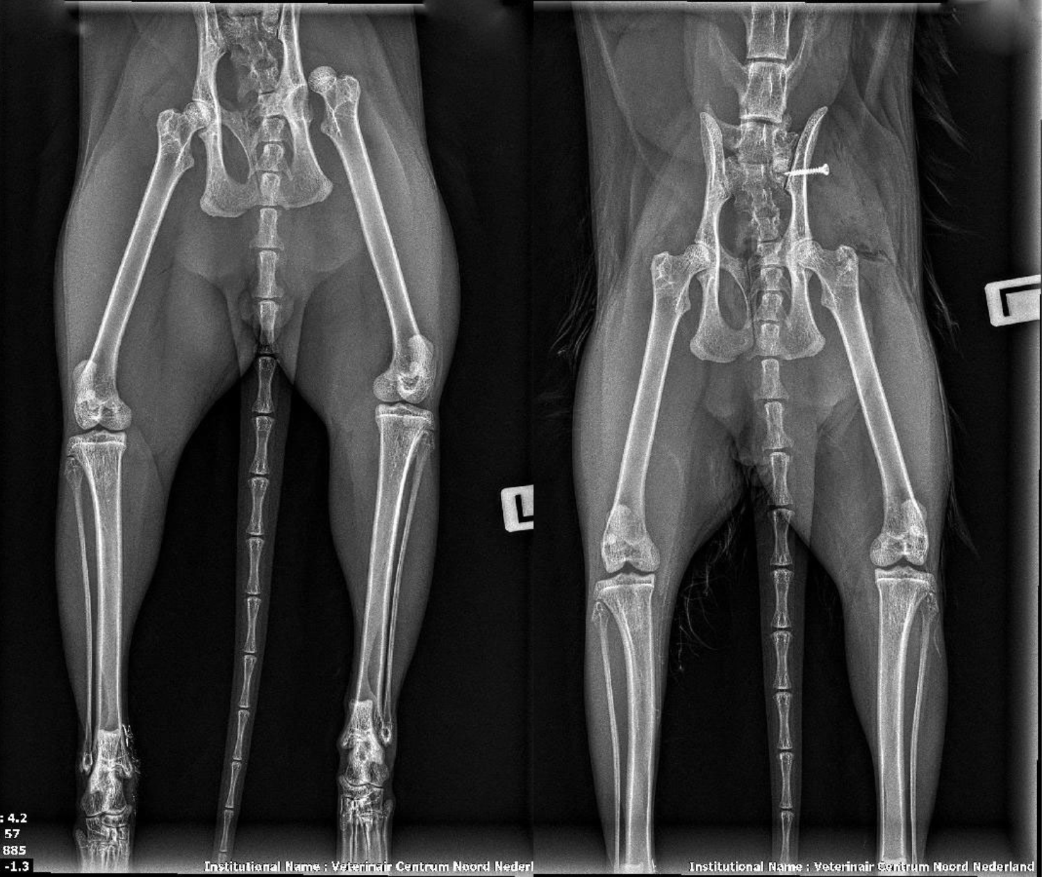Chirurgische repositie of resectie